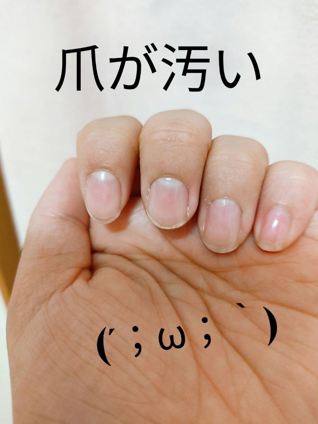 爪美活ネイルオイル/DAISO/ネイルオイル・トリートメントを使ったクチコミ（1枚目）