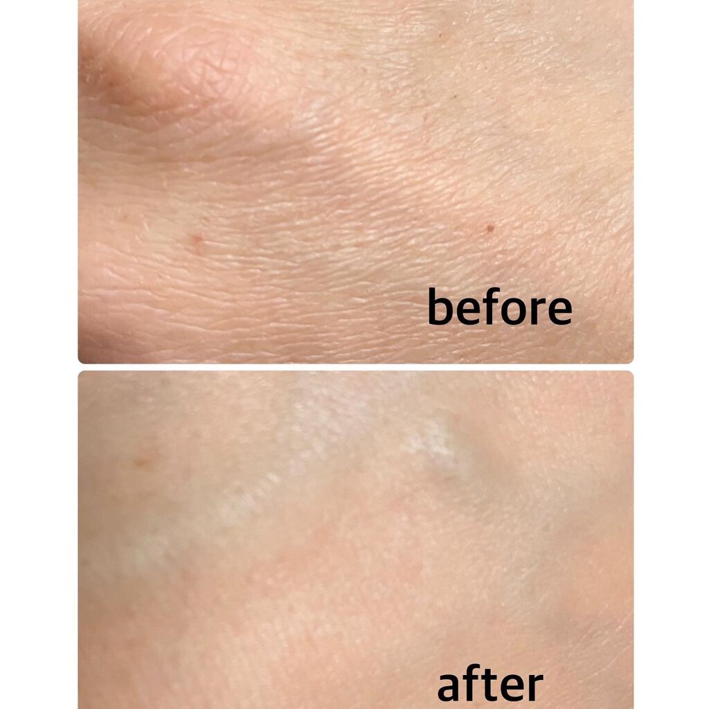 フルフィットプロポリスシナジーパッド/COSRX/トナーパッドを使ったクチコミ(6枚目)