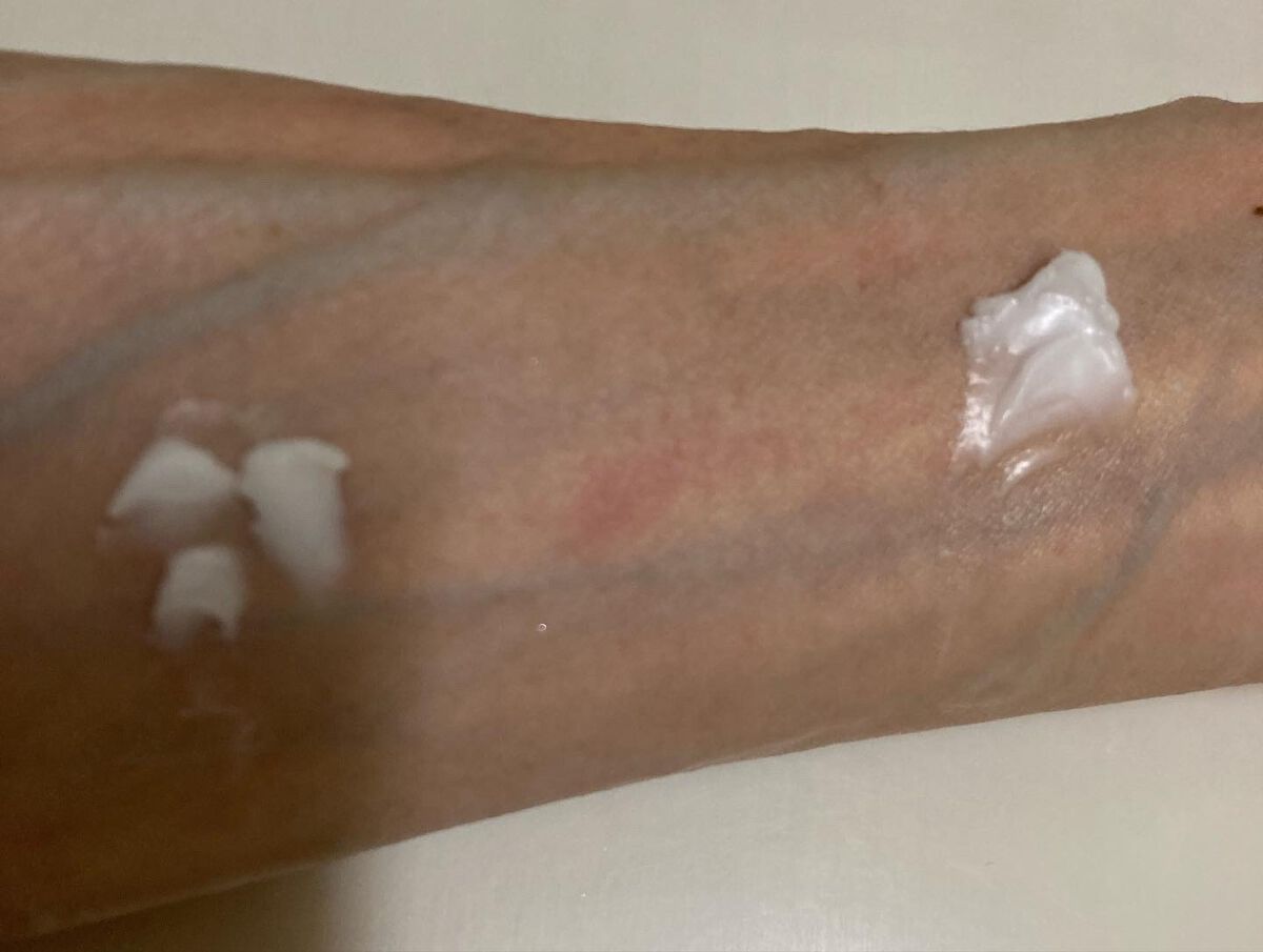 メディコル トライアルセット/ナノエッグ/スキンケアキットを使ったクチコミ(8枚目)