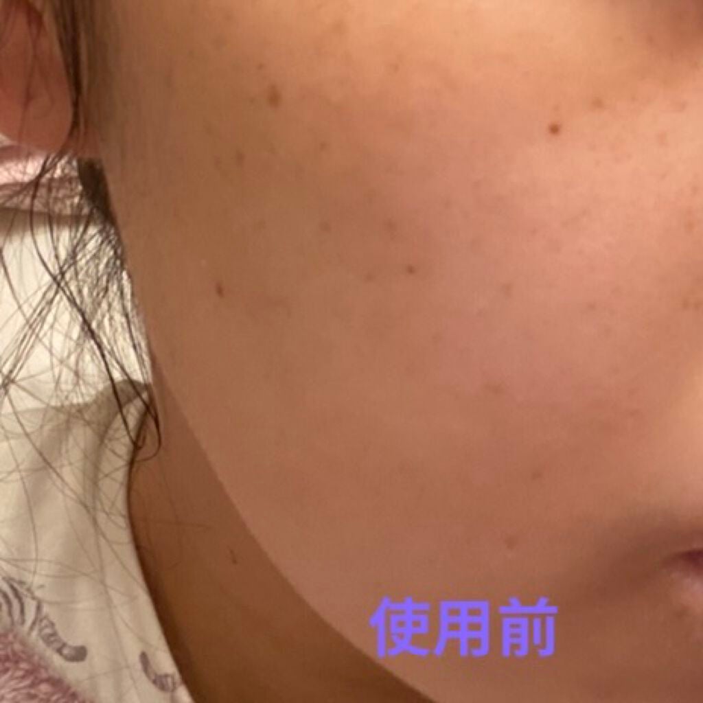 リポソーム アドバンスト リペアセラム/DECORTÉ/美容液を使ったクチコミ(2枚目)