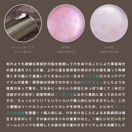 リードルショット100/VT/美容液を使ったクチコミ(7枚目)