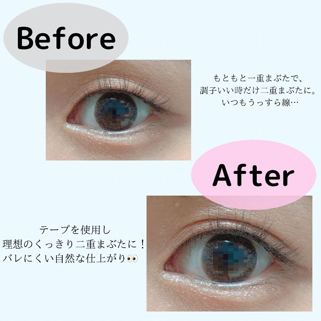 ワンダーアイリッドテープ Extra/D-UP/二重まぶた用アイテムを使ったクチコミ(2枚目)