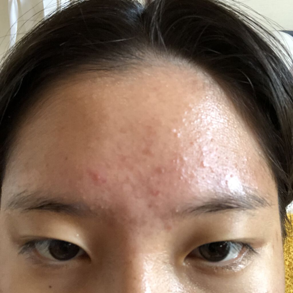 ディープモイスチャースプレー/キュレル/ミスト状化粧水を使ったクチコミ（3枚目）