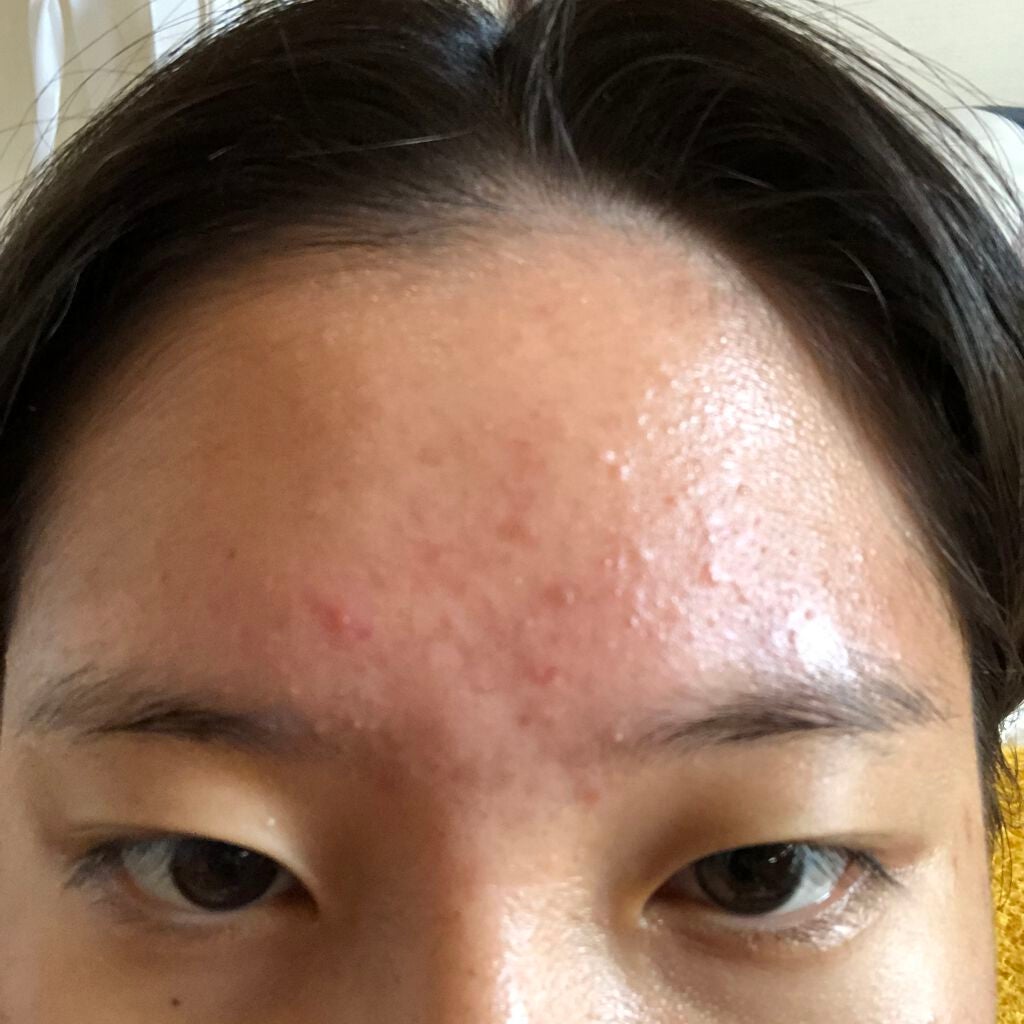 ディープモイスチャースプレー/キュレル/ミスト状化粧水を使ったクチコミ(3枚目)