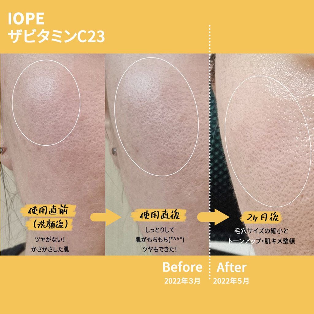 ザビタミンC23/IOPE/美容液を使ったクチコミ(4枚目)