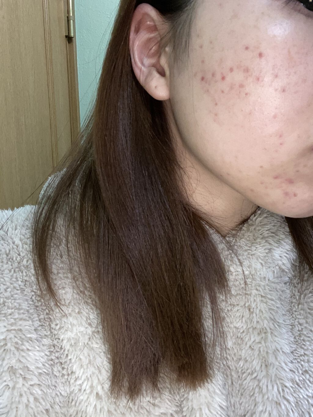 紫雲膏（医薬品）/クラシエ薬品/その他を使ったクチコミ（2枚目）