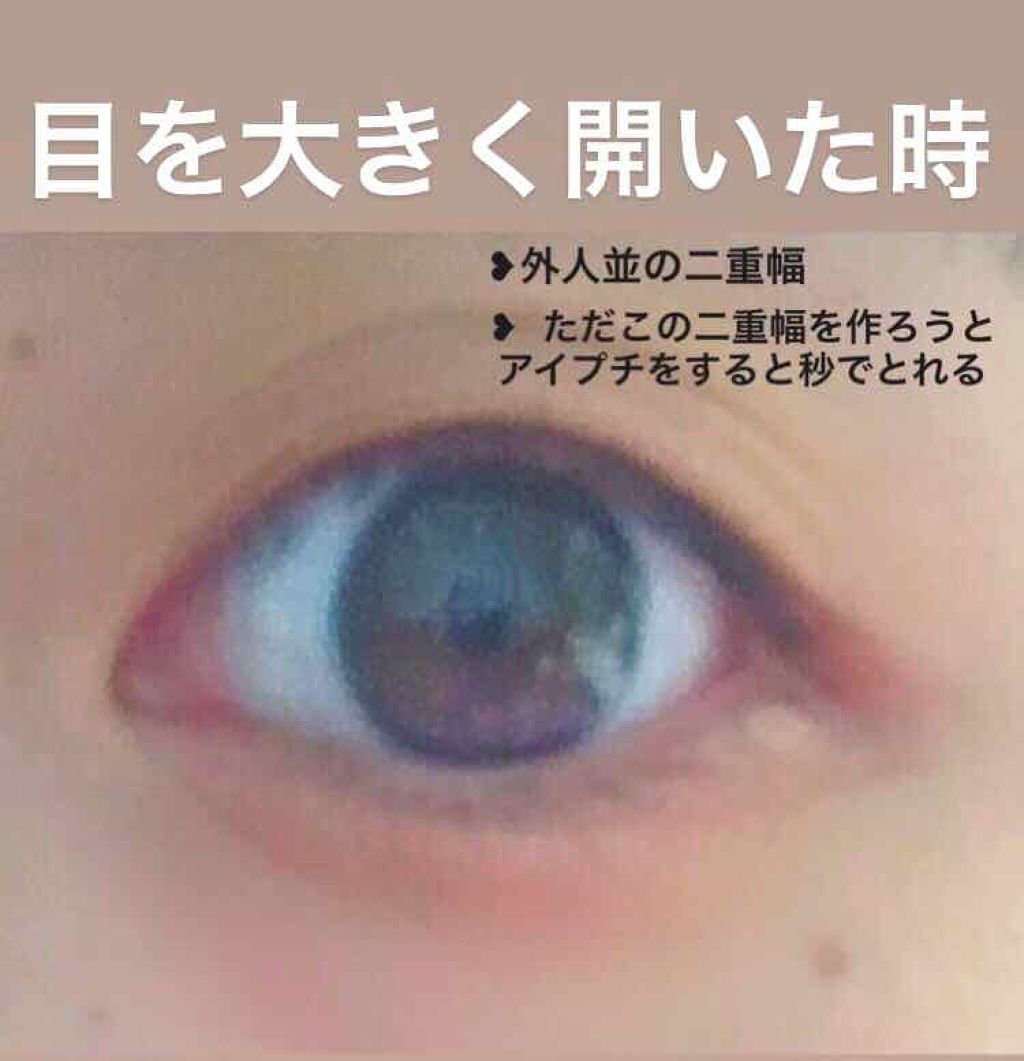 アイビューティー フィクサー WP/アストレア ヴィルゴ/二重まぶた用アイテムを使ったクチコミ（3枚目）