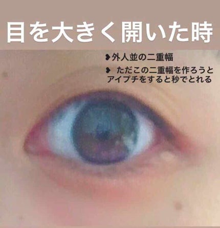 アイビューティー フィクサー WP/アストレア ヴィルゴ/二重まぶた用アイテムを使ったクチコミ(3枚目)