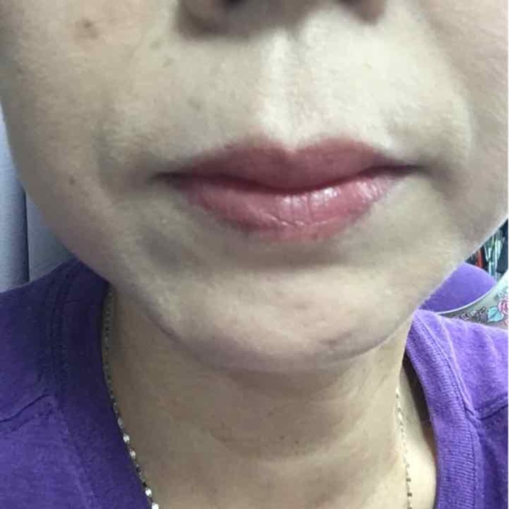 トレースレス タッチ ファンデーション SPF 45 サテンマット クッション コンパクト/TOM FORD BEAUTY/クッションファンデーションを使ったクチコミ（3枚目）