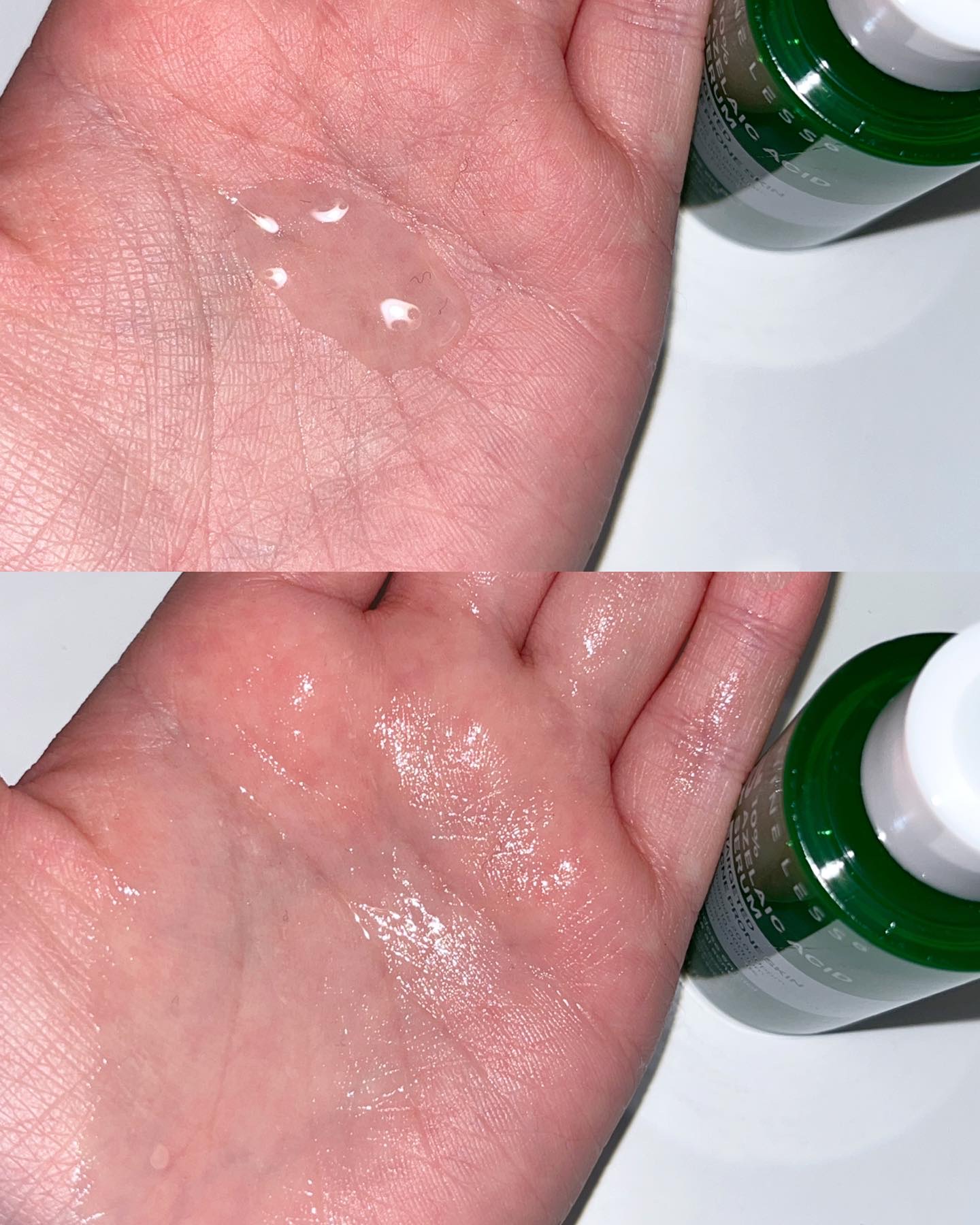 A-Control 10%アゼライックアシッドセラム/NINELESS/美容液を使ったクチコミ（3枚目）