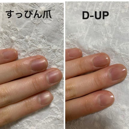 ディーアップファンデーション/D-UP/ネイルベースコートを使ったクチコミ(1枚目)