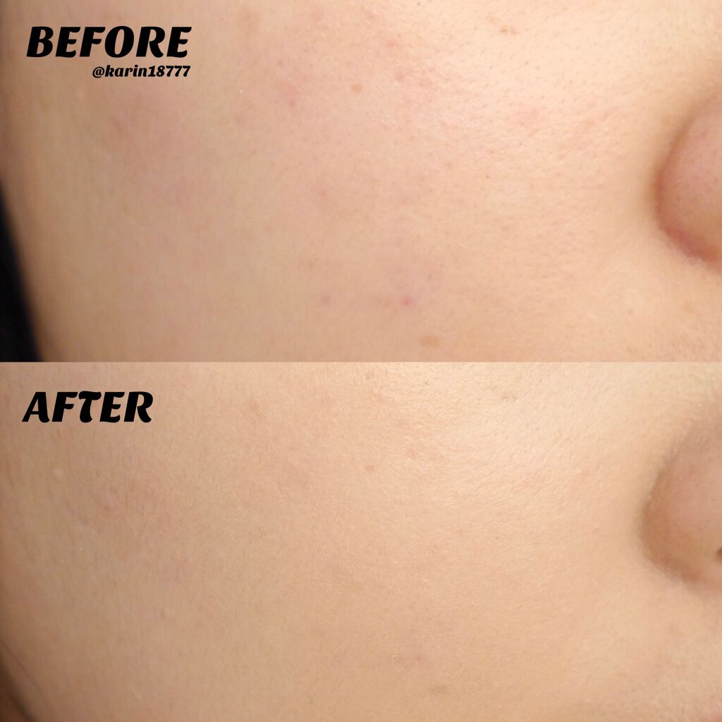 ピンクティーツリーカバークッション/APLIN/クッションファンデーションを使ったクチコミ（3枚目）