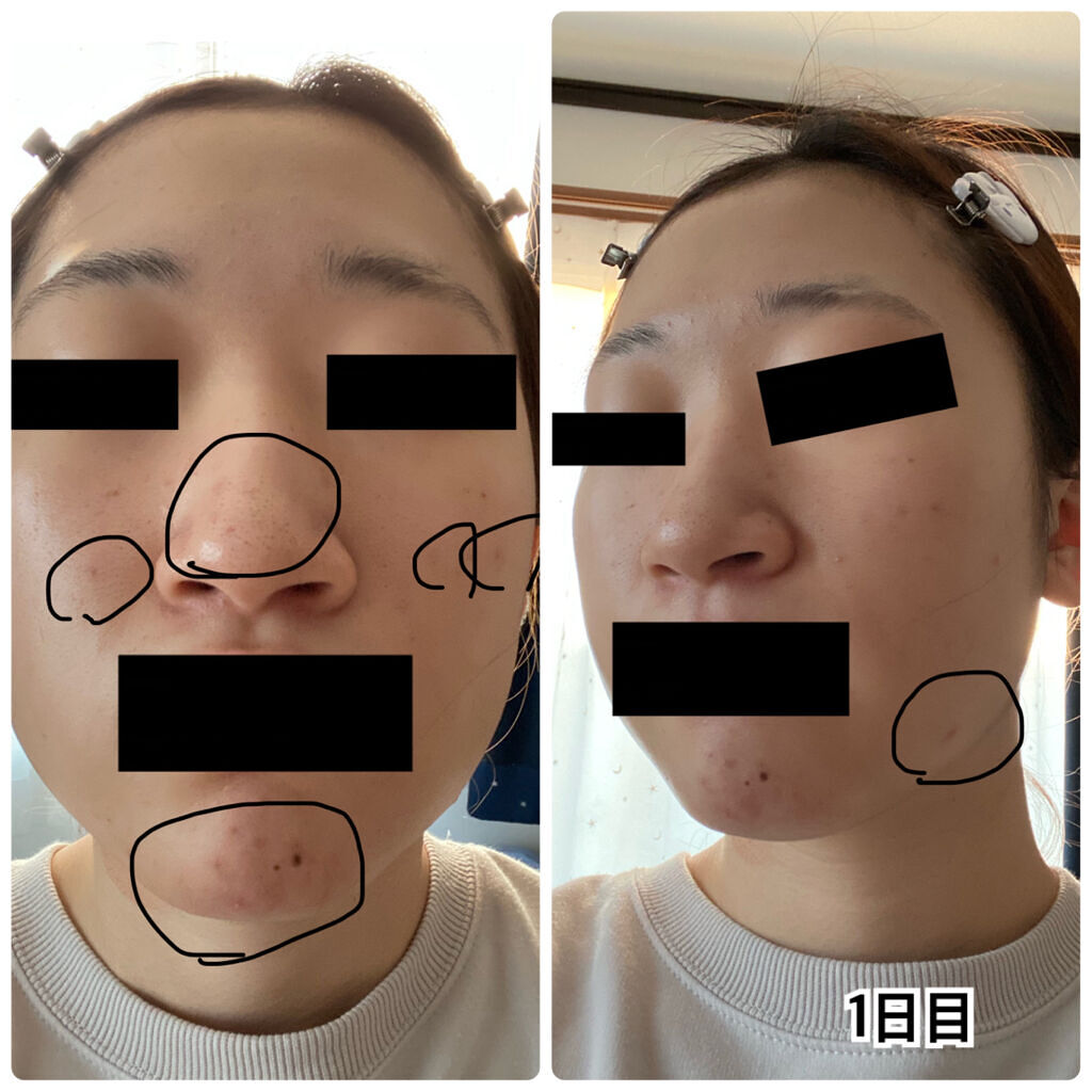 CICA マイルドフォームクレンザー/VT/洗顔フォームを使ったクチコミ（2枚目）