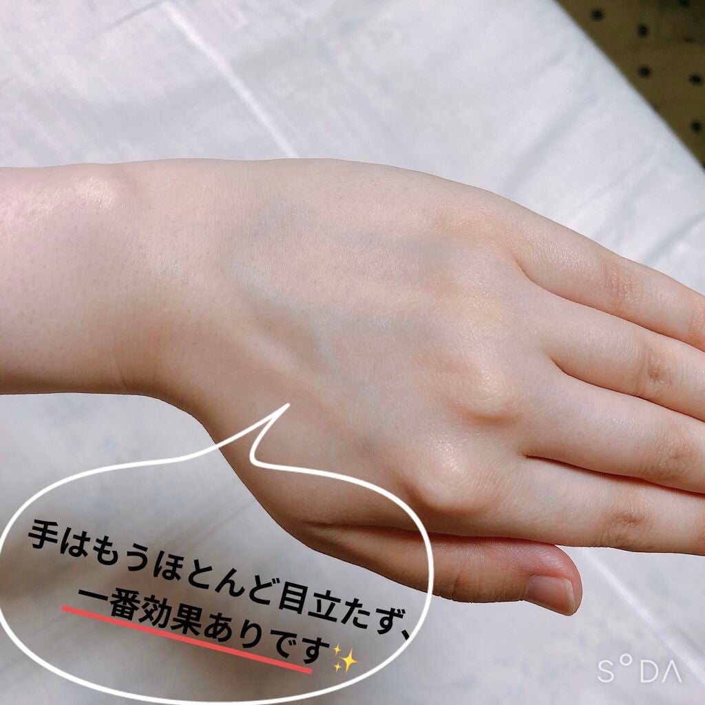 光脱毛器 VIO/Sarlisi/家庭用脱毛器を使ったクチコミ(3枚目)