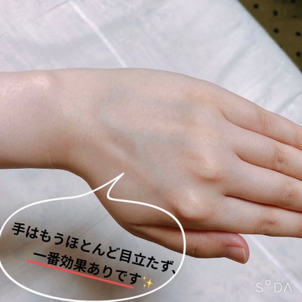 光脱毛器 VIO/Sarlisi/家庭用脱毛器を使ったクチコミ(3枚目)