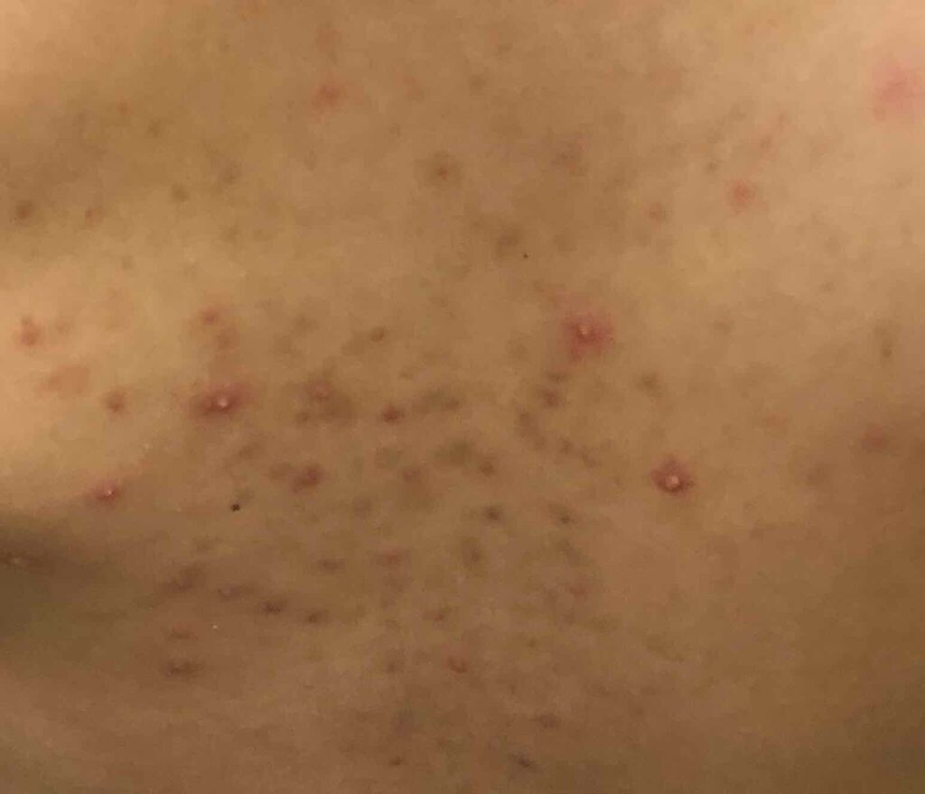 セナキュア(医薬品)/小林製薬/その他を使ったクチコミ(3枚目)