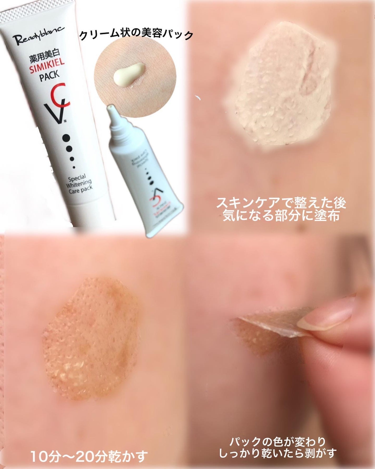 レディブラン 薬用美白シミキールパックC/シーヴァ/ピーリングを使ったクチコミ(2枚目)