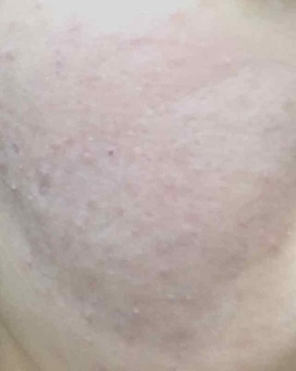 カラーミキシングコンシーラー/キャンメイク/パレットコンシーラーを使ったクチコミ(4枚目)