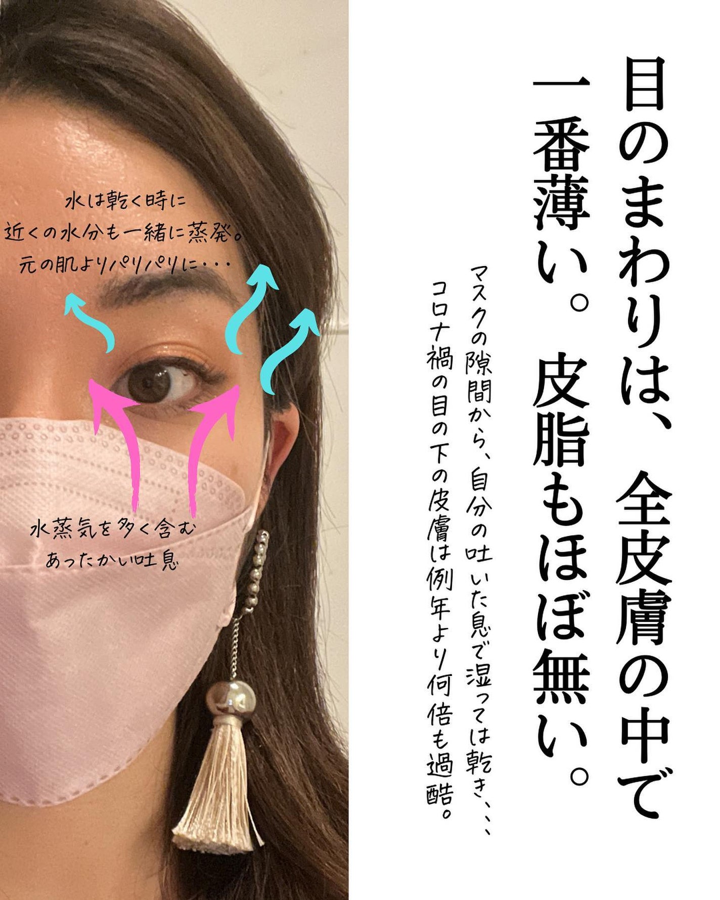 おゆみ|ニキビ・ニキビ跡ケア on LIPS 「【マスクトラブルに負けるな①目元の砂漠化】こんばんは、おゆみで..」(4枚目)