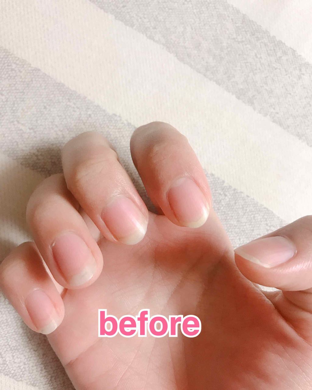 ネイルケアオイル 無印良品の口コミ 爪を丈夫にしてピンクの部分を伸ばす 初投 By 爽 混合肌 Lips ネイルケアオイル 無印良品の口コミ 爪を丈夫にしてピンクの部分を伸ばす 初投 By 爽 混合肌 Lips