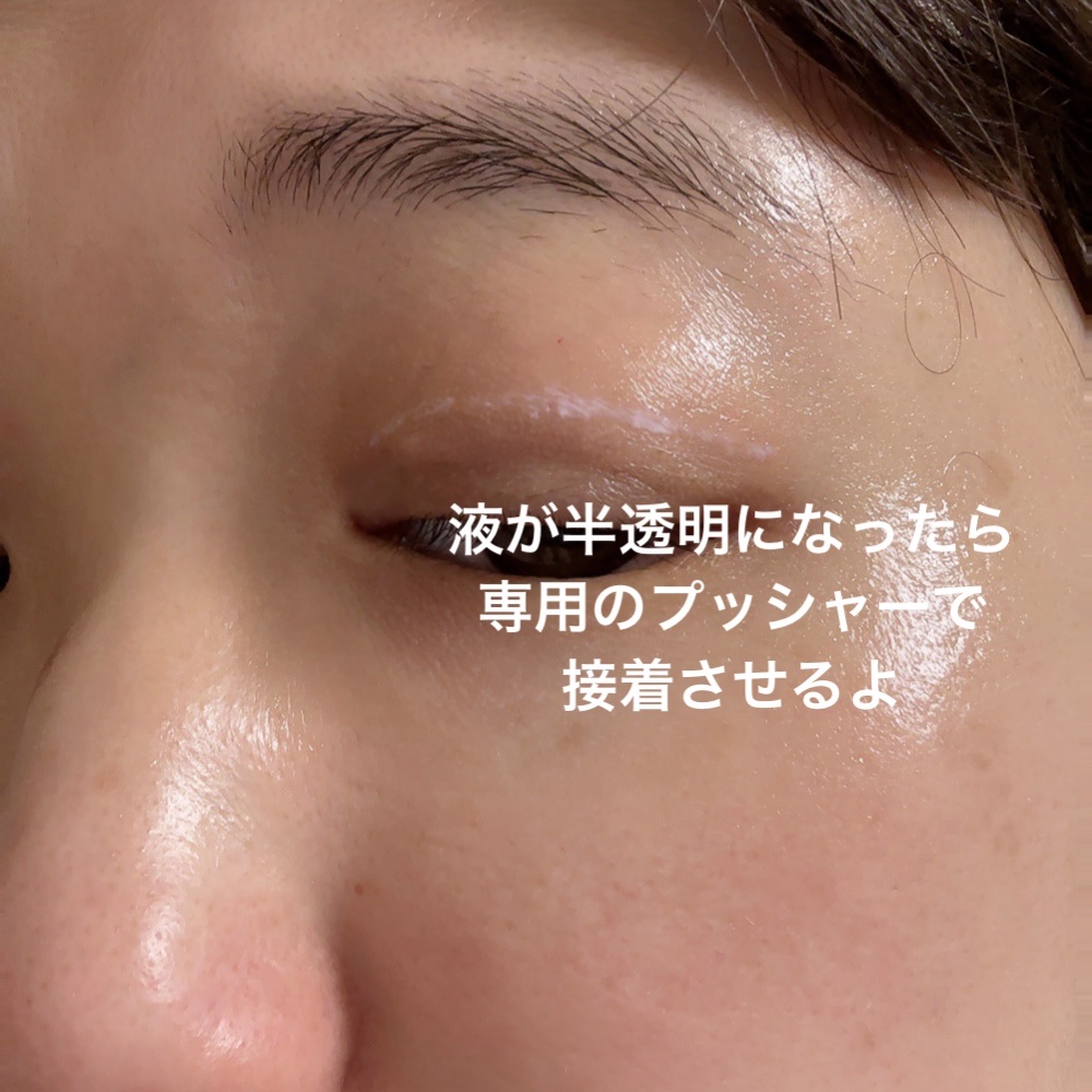 TWOOL ダブルアイリッドグルー/SHOBIDO/二重まぶた用アイテムを使ったクチコミ（3枚目）