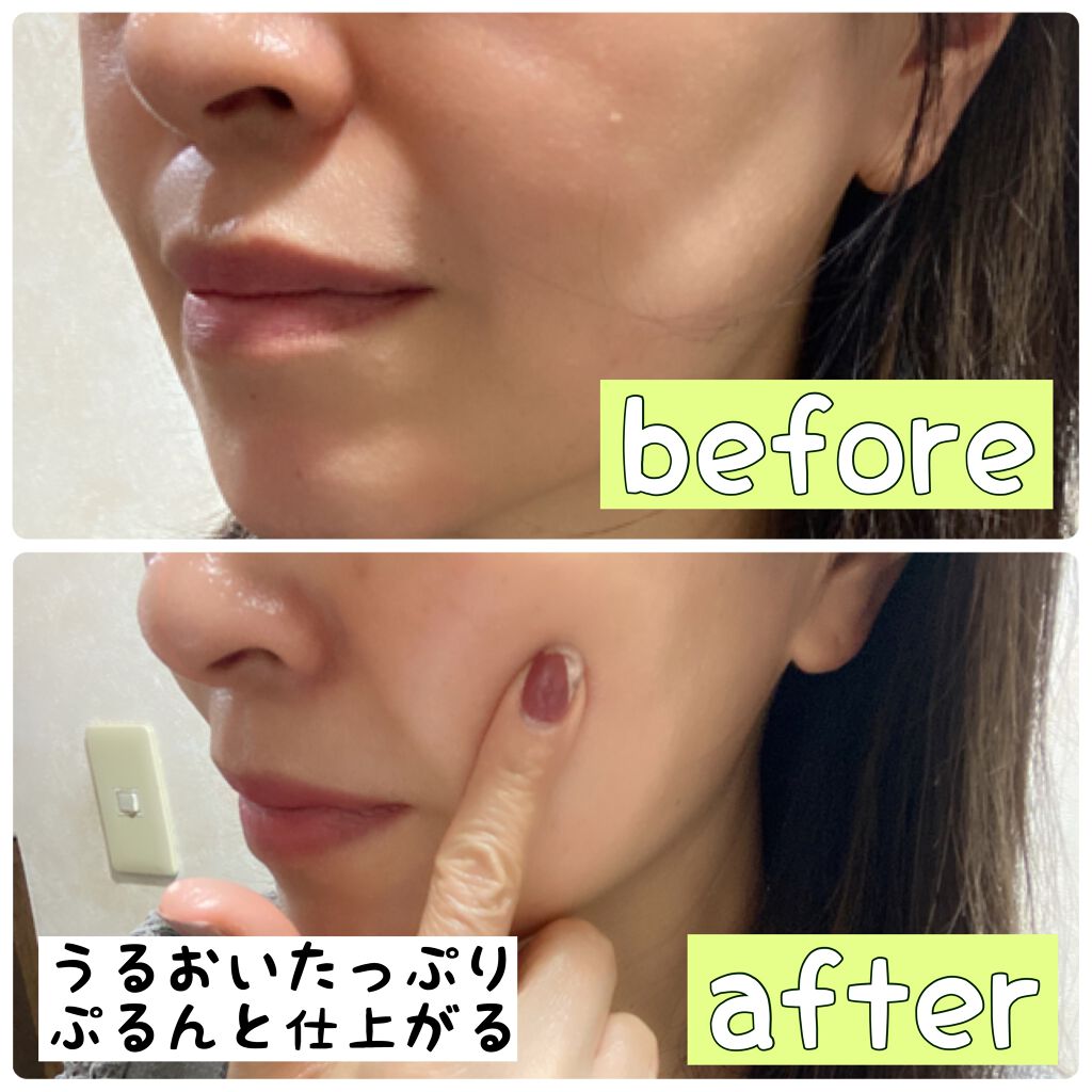 シカ メソッド クリーム/コジット/フェイスクリームを使ったクチコミ（3枚目）