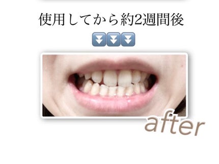 Natsuki on LIPS 「薬用ホワイトニングデンタブラッシュEX xiva シーヴ..」(5枚目)