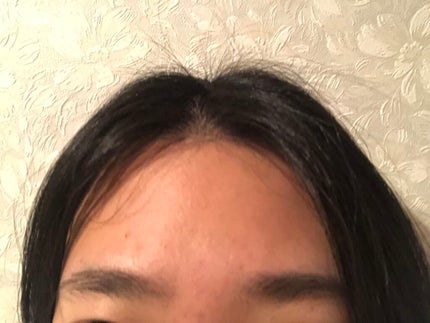 艶肌ドロップ/ラッシュ/美容液を使ったクチコミ(5枚目)