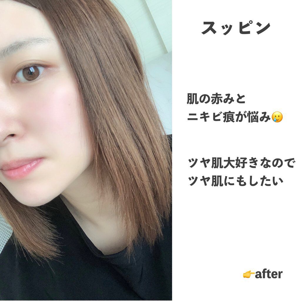 ナチュラル チークN/CEZANNE/パウダーチークを使ったクチコミ(4枚目)