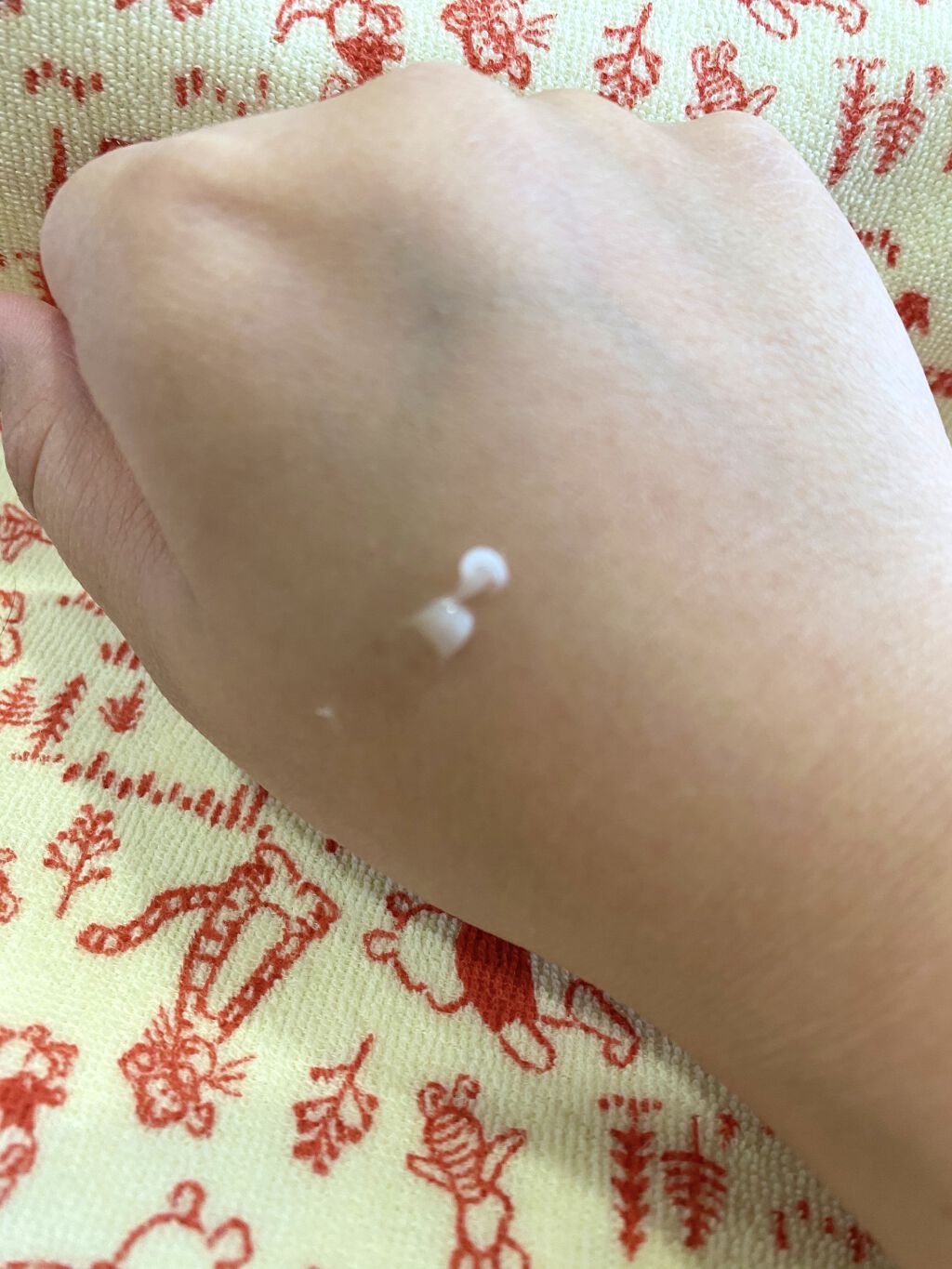 モアリップ N (医薬品)/資生堂薬品/その他を使ったクチコミ（3枚目）