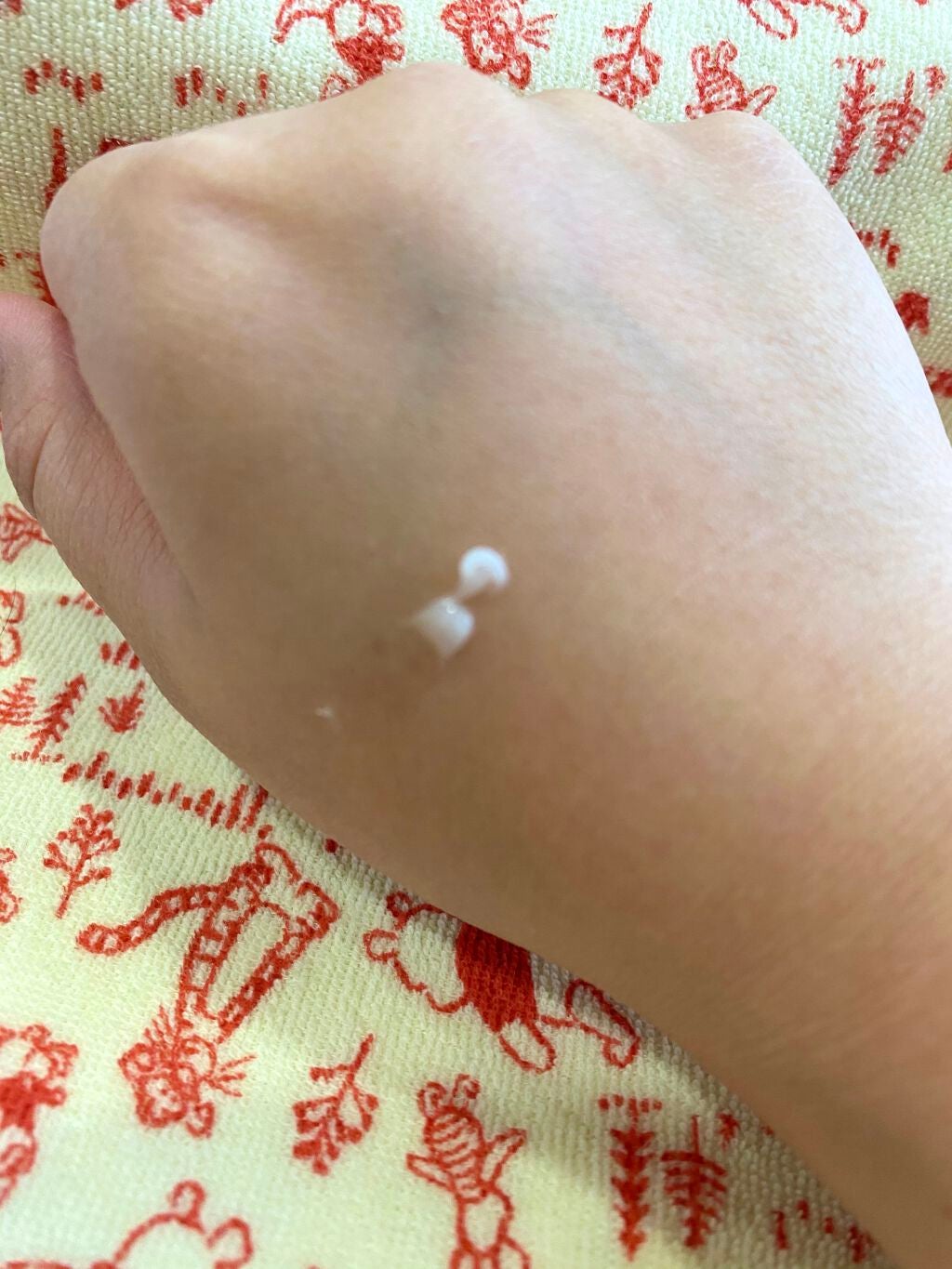 モアリップ N (医薬品)/資生堂薬品/その他を使ったクチコミ(3枚目)