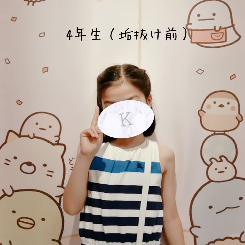 ストレートヘアアイロン/SALONIA/ストレートアイロンを使ったクチコミ（2枚目）