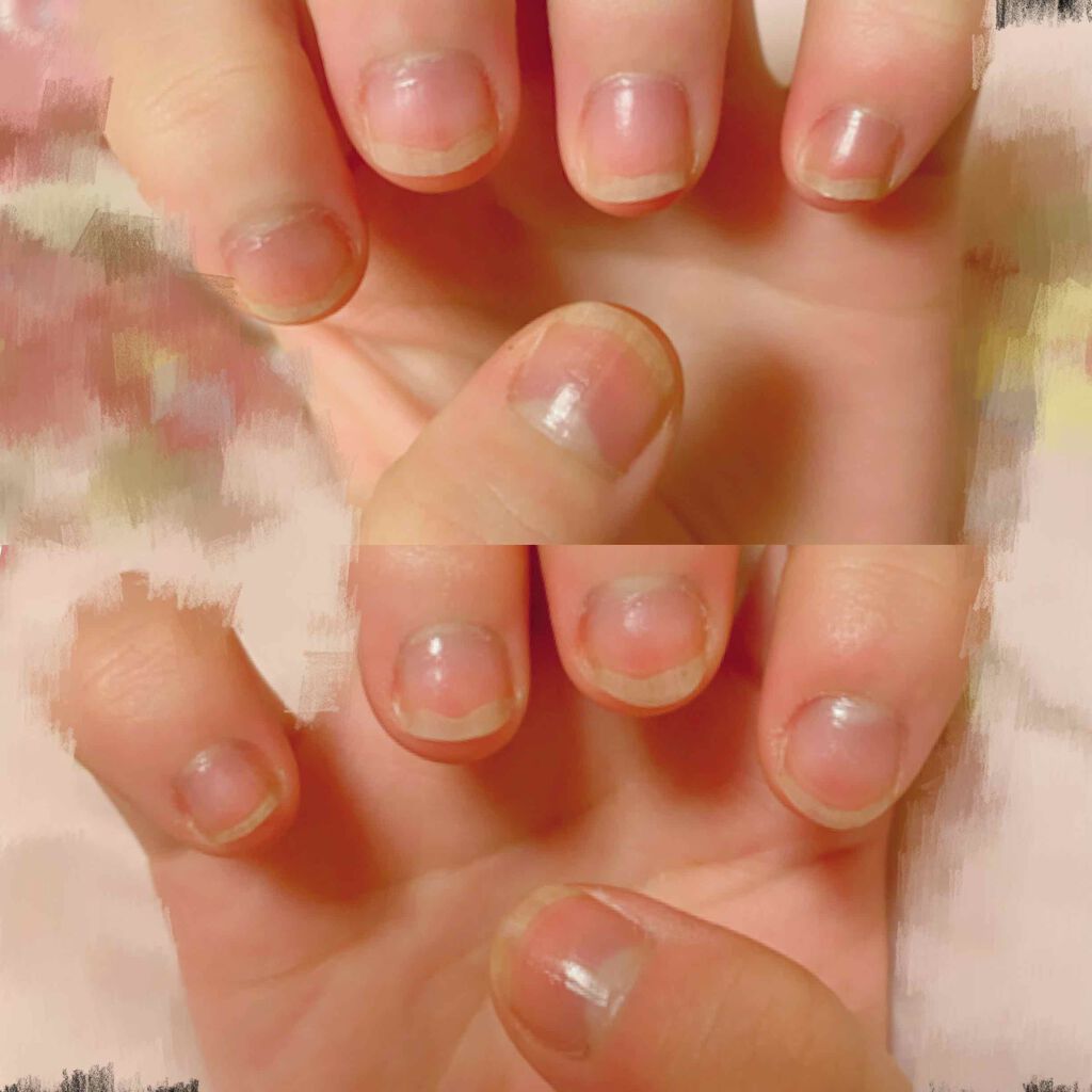 エテュセ クイックケアコート/ettusais/ネイルオイル・トリートメントを使ったクチコミ（2枚目）