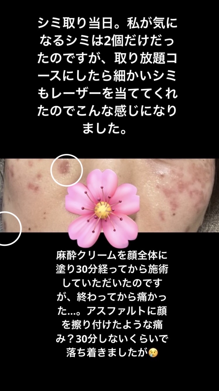 メラノショット W/ONE BY KOSE/美容液を使ったクチコミ（2枚目）