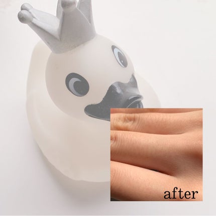 レイボーテ Rフラッシュ プラス/YA-MAN TOKYO JAPAN/家庭用脱毛器を使ったクチコミ(4枚目)