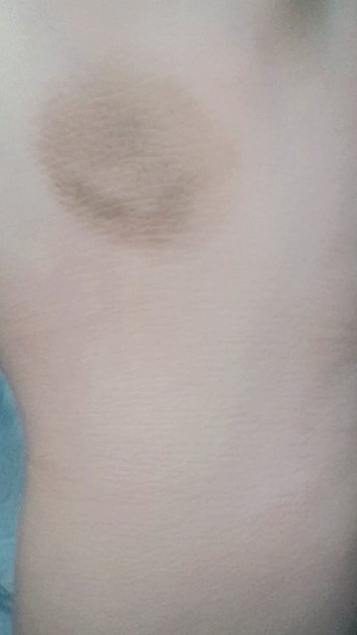 ビッグカバーフィットコンシーラー/ETUDE/リキッドコンシーラーを使ったクチコミ（2枚目）