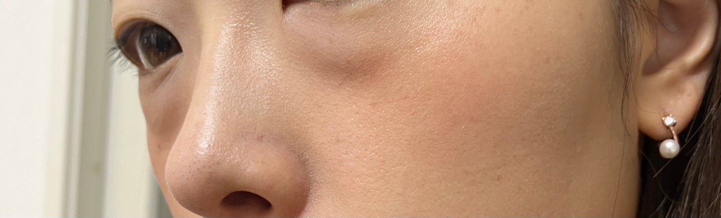 リップ&チーク ボーム N°1 ドゥ シャネル/CHANEL/口紅を使ったクチコミ(3枚目)