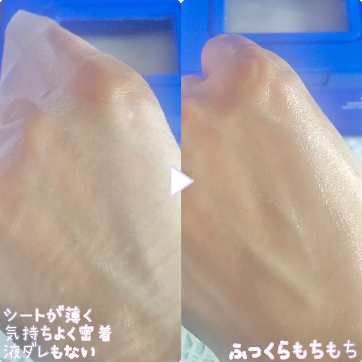 スーパーヒアルロン マスク/VT/シートマスク・パックを使ったクチコミ（2枚目）