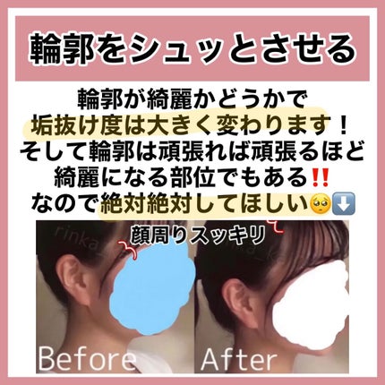 お鼻リフォーマー ハナハナ/グッズマン/その他を使ったクチコミ(5枚目)