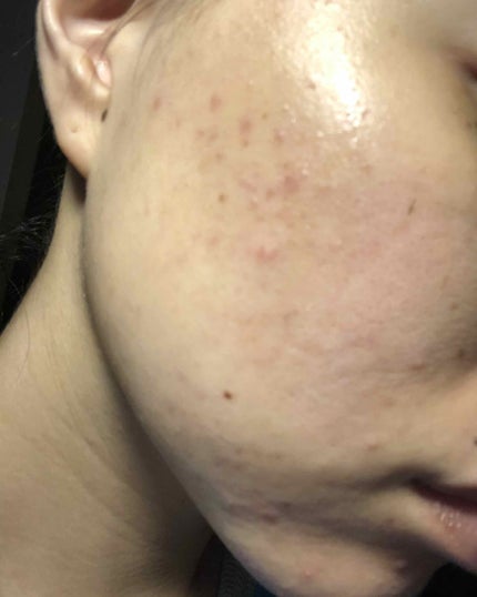 化粧水・敏感肌用・高保湿タイプ/無印良品/化粧水を使ったクチコミ(4枚目)