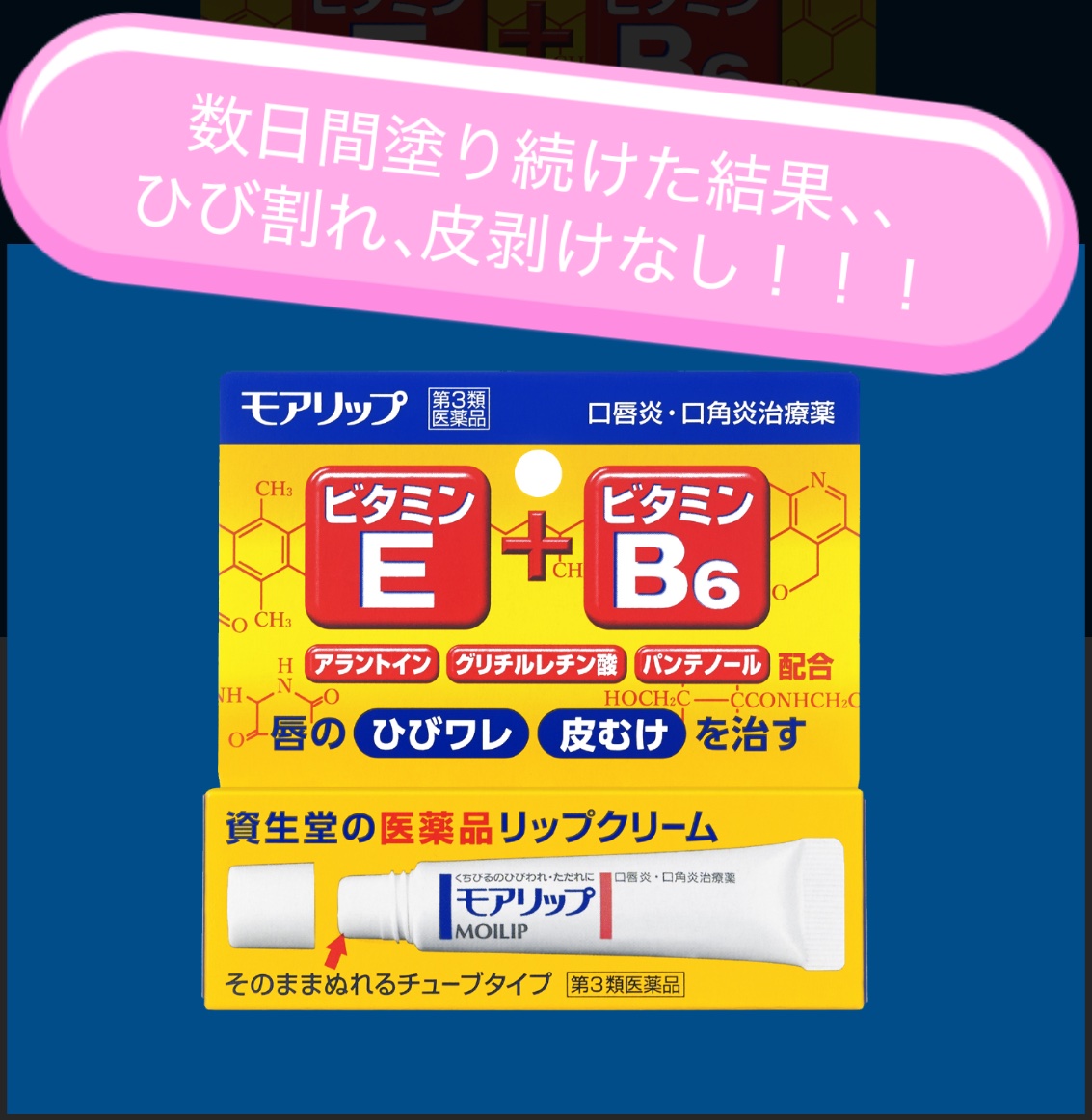 モアリップ N (医薬品)/資生堂薬品/その他を使ったクチコミ（2枚目）