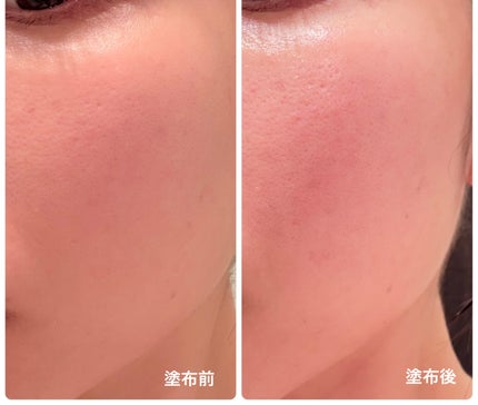 C−クエンスセラム 4プラス/エンビロン/美容液を使ったクチコミ(2枚目)