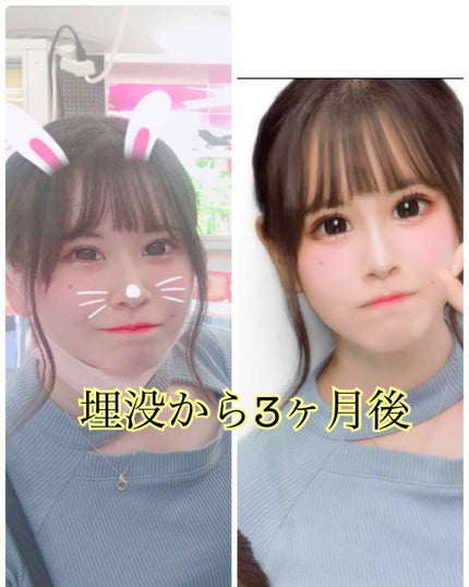 äºéæŽåœ¢/ãã®ä»ã䜿ã£ãã¯ãã³ãïŒ3æç®ïŒ