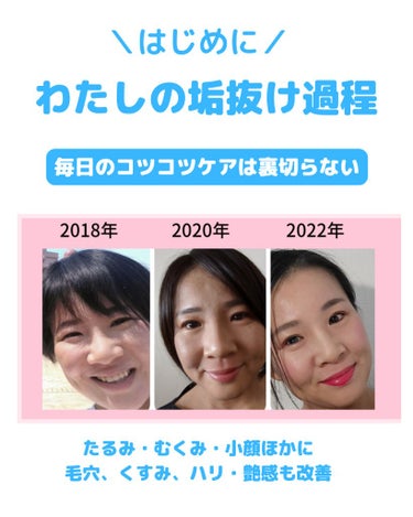 美肌カウンセラー💆綺麗のお助け相談所 on LIPS 「今日から誰でも作る"垢抜け顔"。元重度のアトピーから改善したわ..」（2枚目）