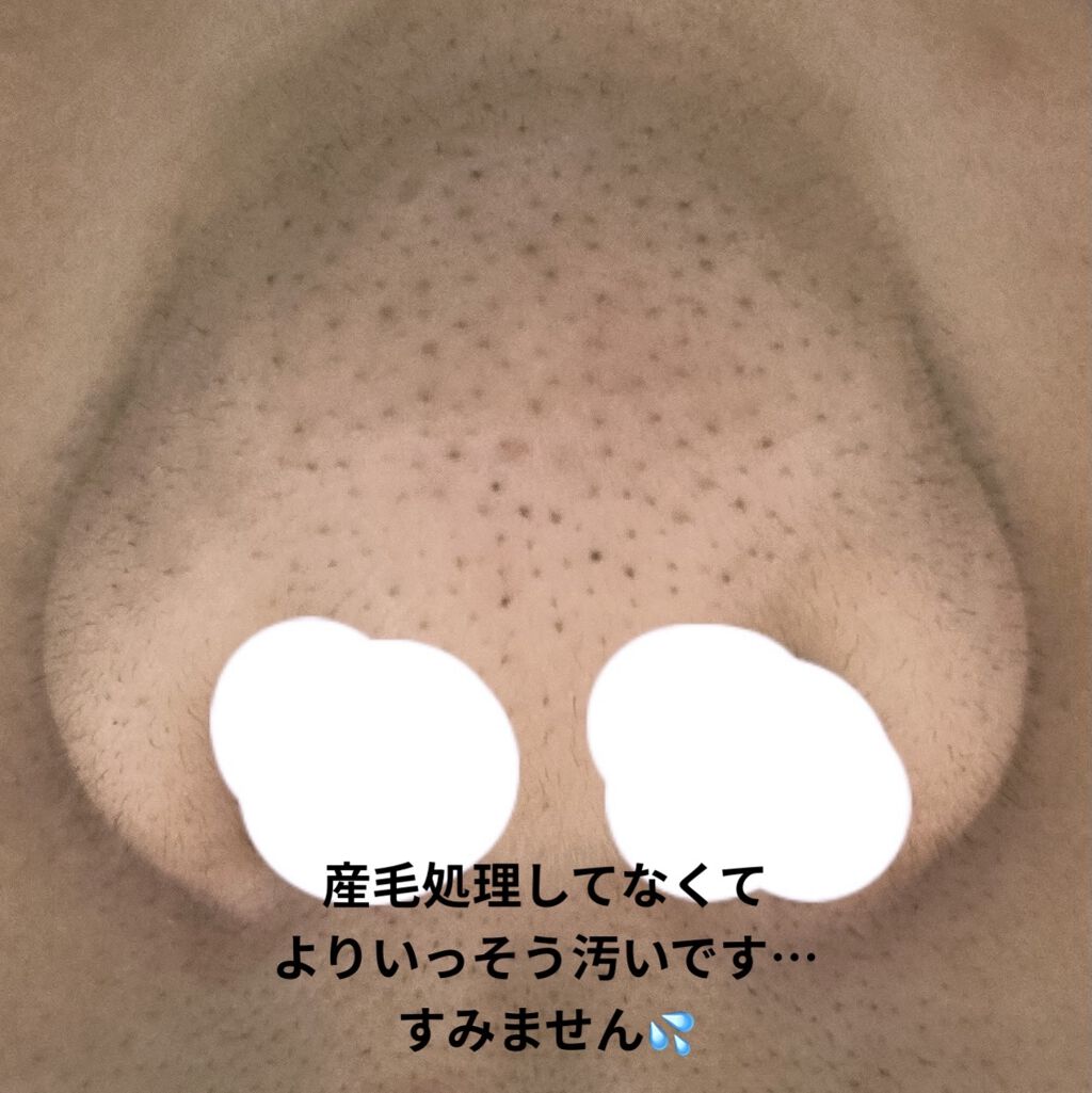 デュオ ザ クレンジングバーム ブラック/DUO/クレンジングバームを使ったクチコミ（2枚目）