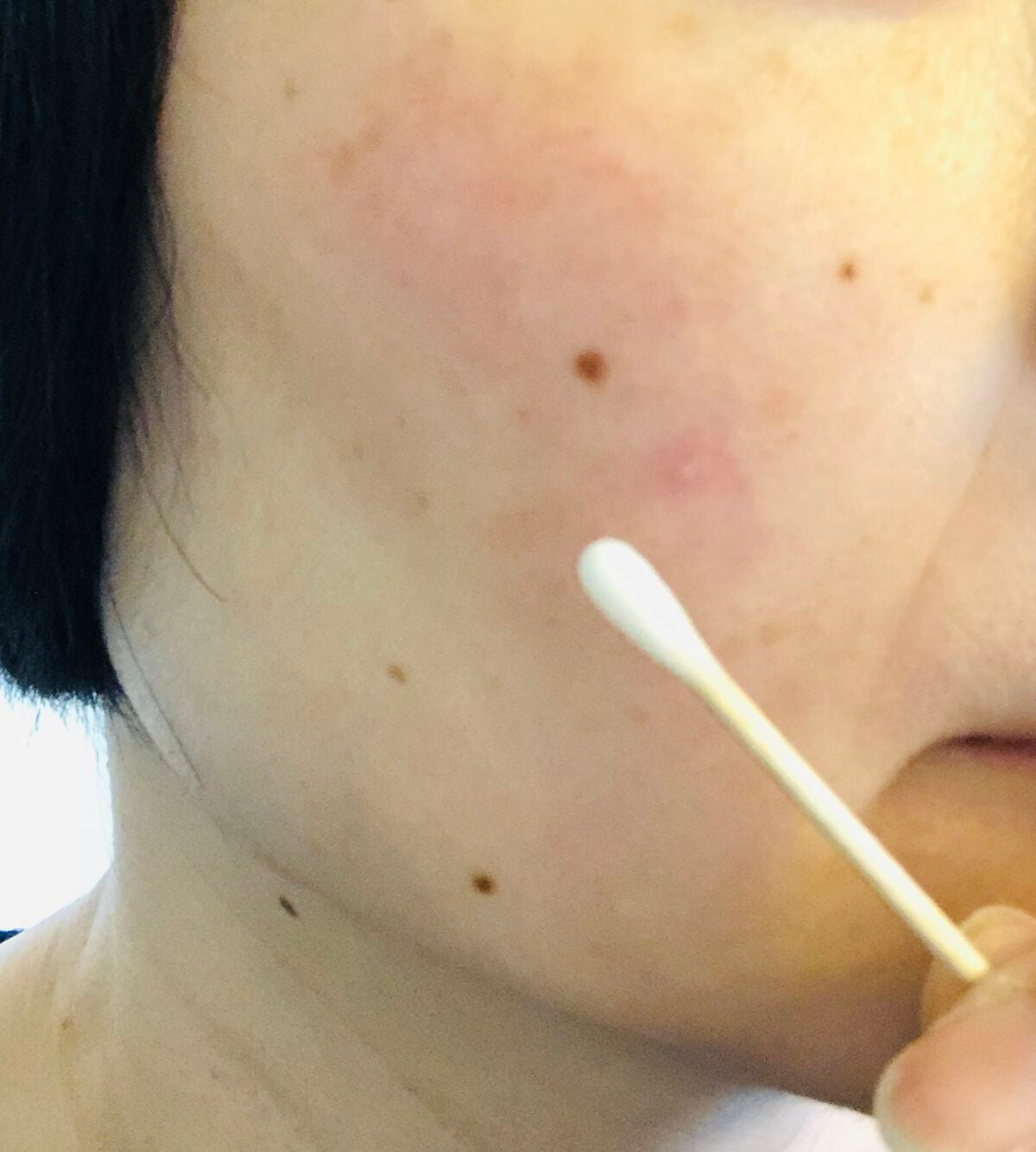 マジックティーツリーオイル/ブラン/フェイスオイルを使ったクチコミ(4枚目)