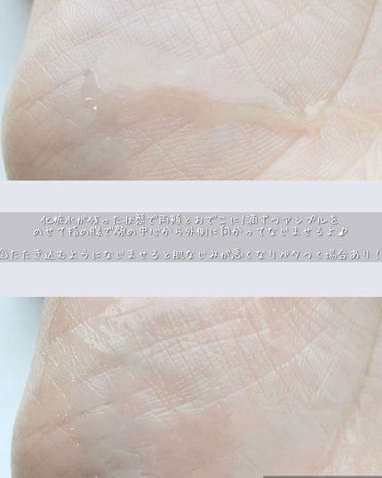 ã°ã«ã¿ ãã¿ãã³C ããŒãã³ã° ã¢ã³ãã«/IOPE/çŸå®¹æ¶²ã䜿ã£ãã¯ãã³ãïŒ4æç®ïŒ