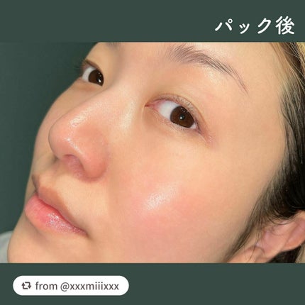 ルルルンプレシャス WHITE(クリア)【旧】/ルルルン/シートマスク・パックを使ったクチコミ(5枚目)