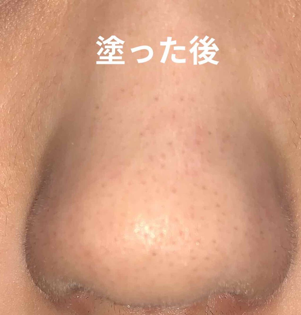 小鼻角質粘着糊/ポアナイス/シートマスク・パックを使ったクチコミ(3枚目)