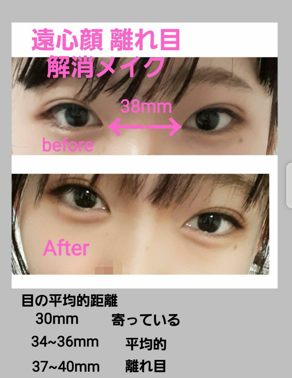 アイビューティー フィクサー WP/アストレア ヴィルゴ/二重まぶた用アイテムを使ったクチコミ（1枚目）